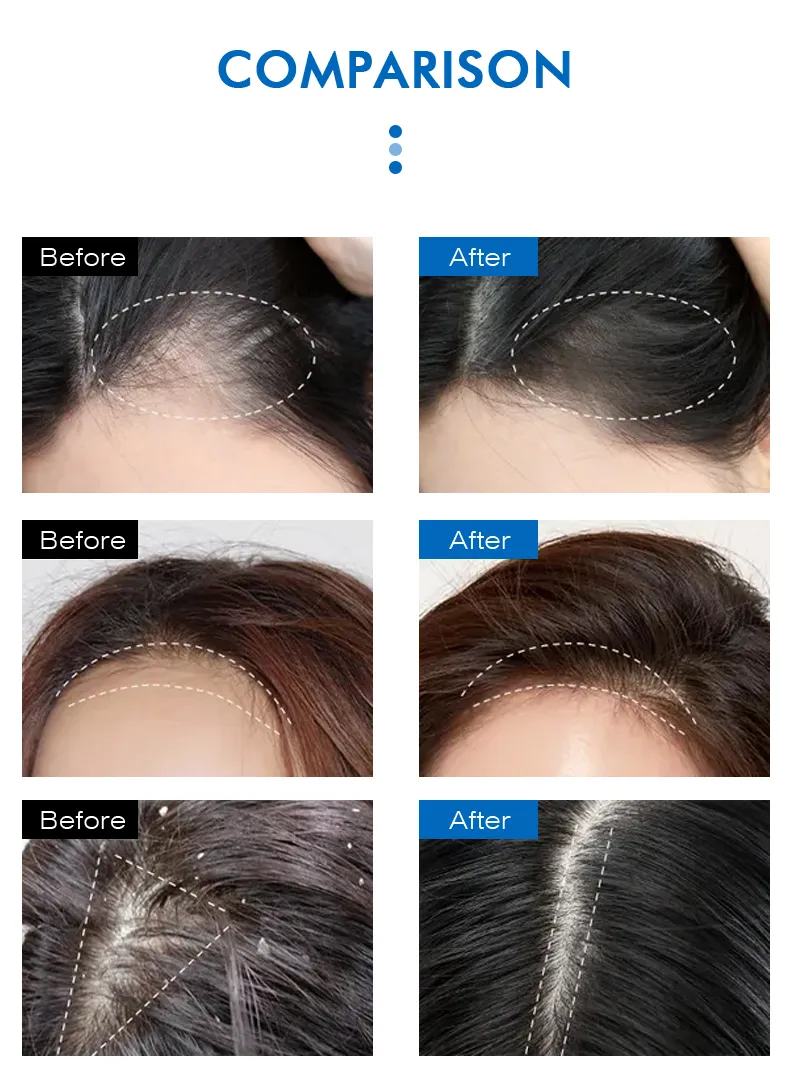 Customize Logo Natural Hair Luxury Blue Copper Peptide Shampoo Hair Care Growth Color Protection Shampoo