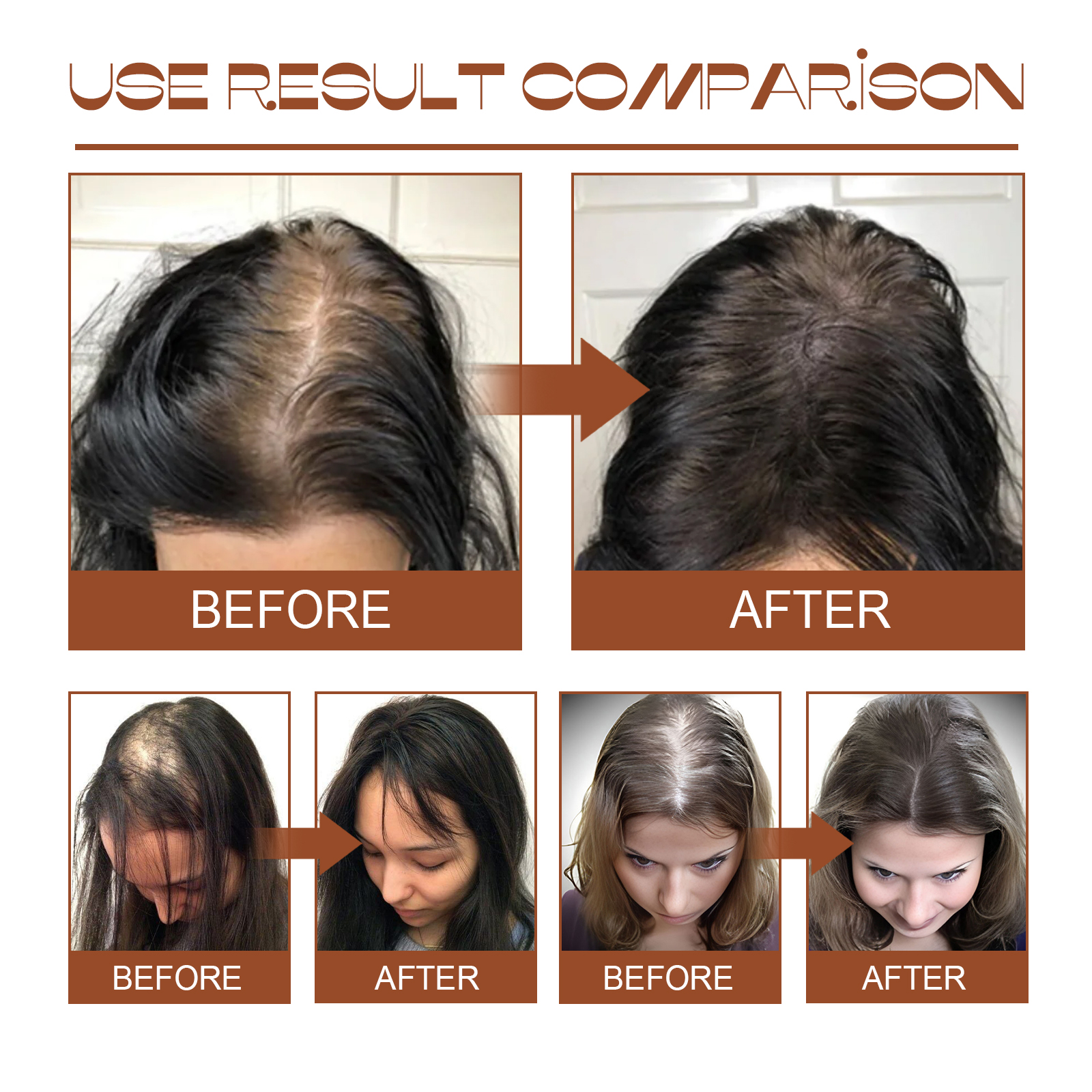 EELHOE 100% Unrefined Vegan Batana Oil Shampoo &amp; Conditioner Leave-In Moisturizing Strengthening Repair Hair Growth Cream