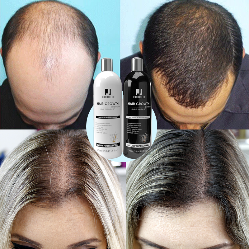 Private Label Best Strengthens Density Organic Biotin Anti Loss Fall Hair Growth Shampoo and Conditioner