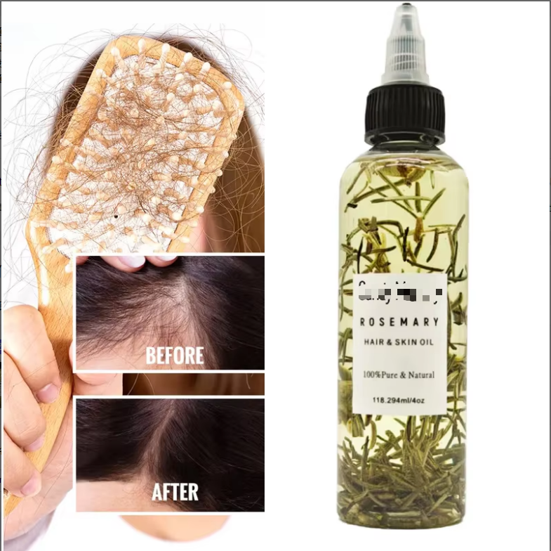 Rosemary Hair Growth Oil &amp; Shampoo Nourishing Anti-Frizz Scalp Care Private Label Wholesale Organic 100ml/200ml
