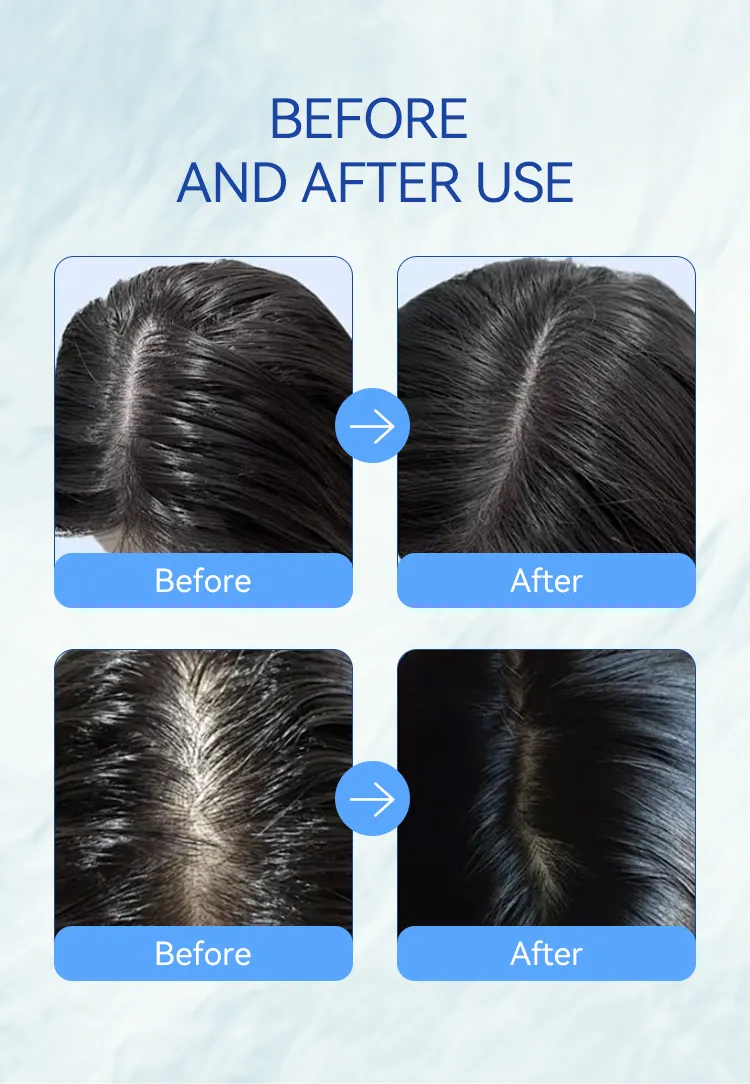 Mocheqi Sulfate Free Mild Organic Nourishing Moisturizing Anti-Dandruff Hair Shampoo for Salon Use Wholesale