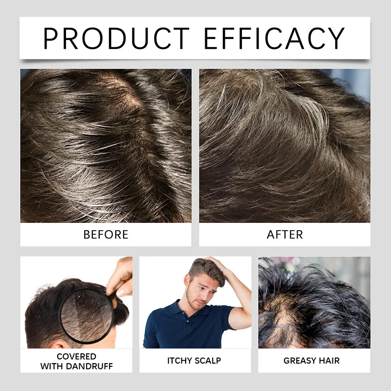 Men's Anti-Dandruff Shampoo Scalp Care & Hair Strength Gel Refreshing Mint