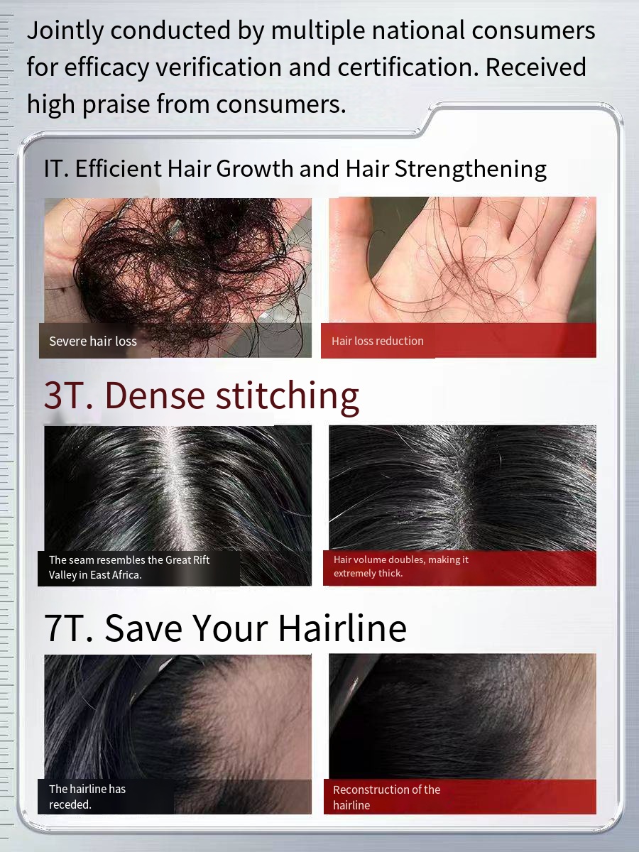 DNA Sodium Oil Control Anti-Hair Loss Anti-Dandruff Shampoo User Tested Reduce Hair Fall 1-3 Weeks Scalp Care Men Women Hair