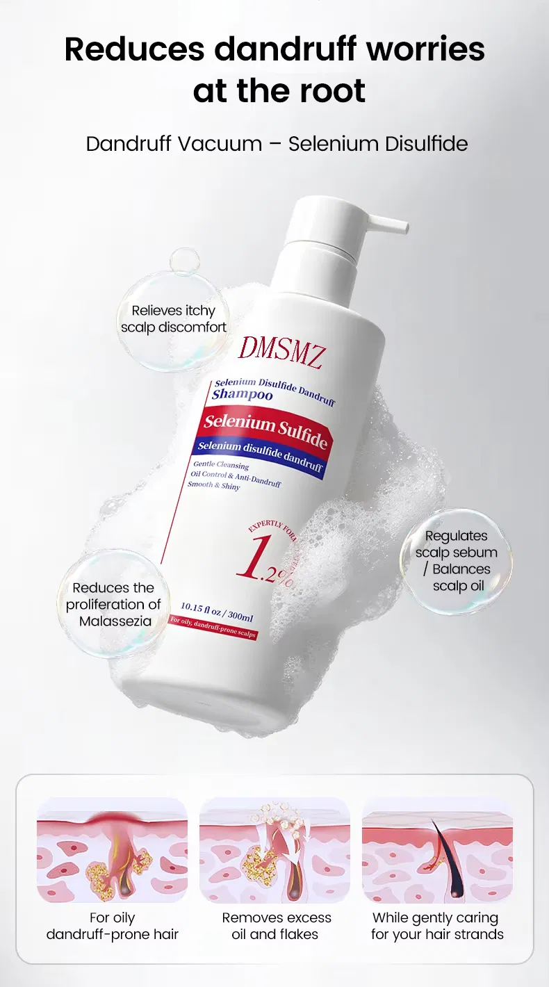 Scalp Treatment