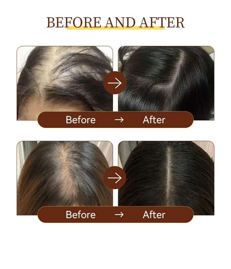 Mocheqi Hair Shampoo Product Detail 6