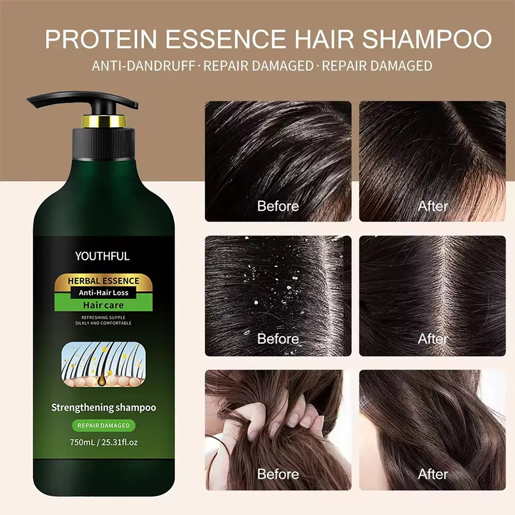Sulfate Free for Strengthen Weak Hair Shampoo Remove Dandruff and Relieve Itching