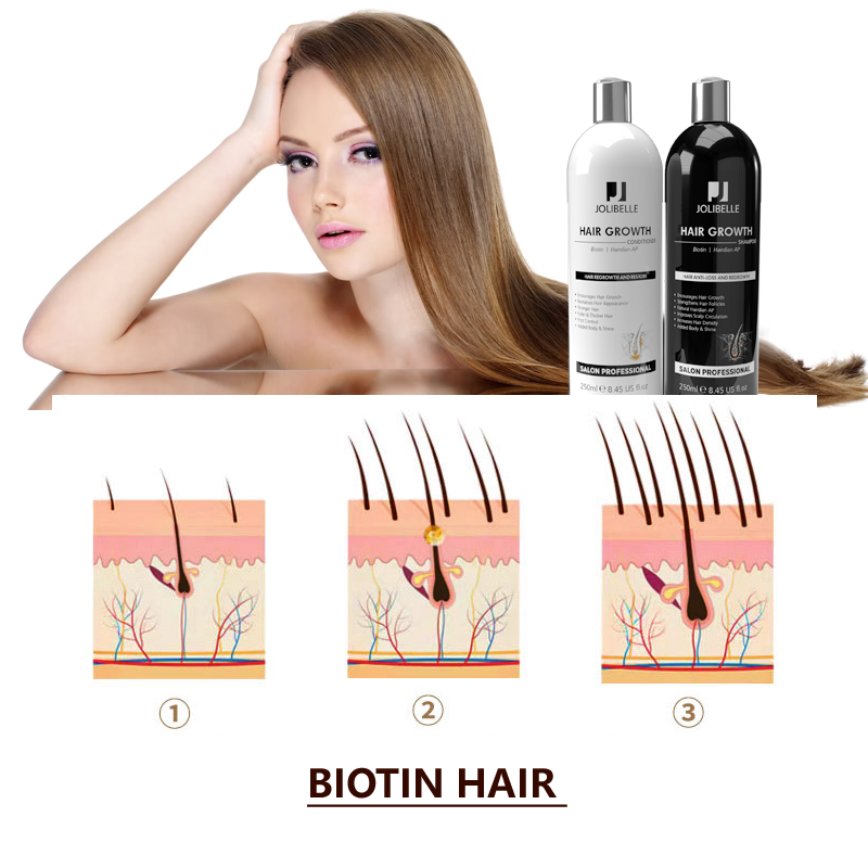 Private Label Best Strengthens Density Organic Biotin Anti Loss Fall Hair Growth Shampoo and Conditioner