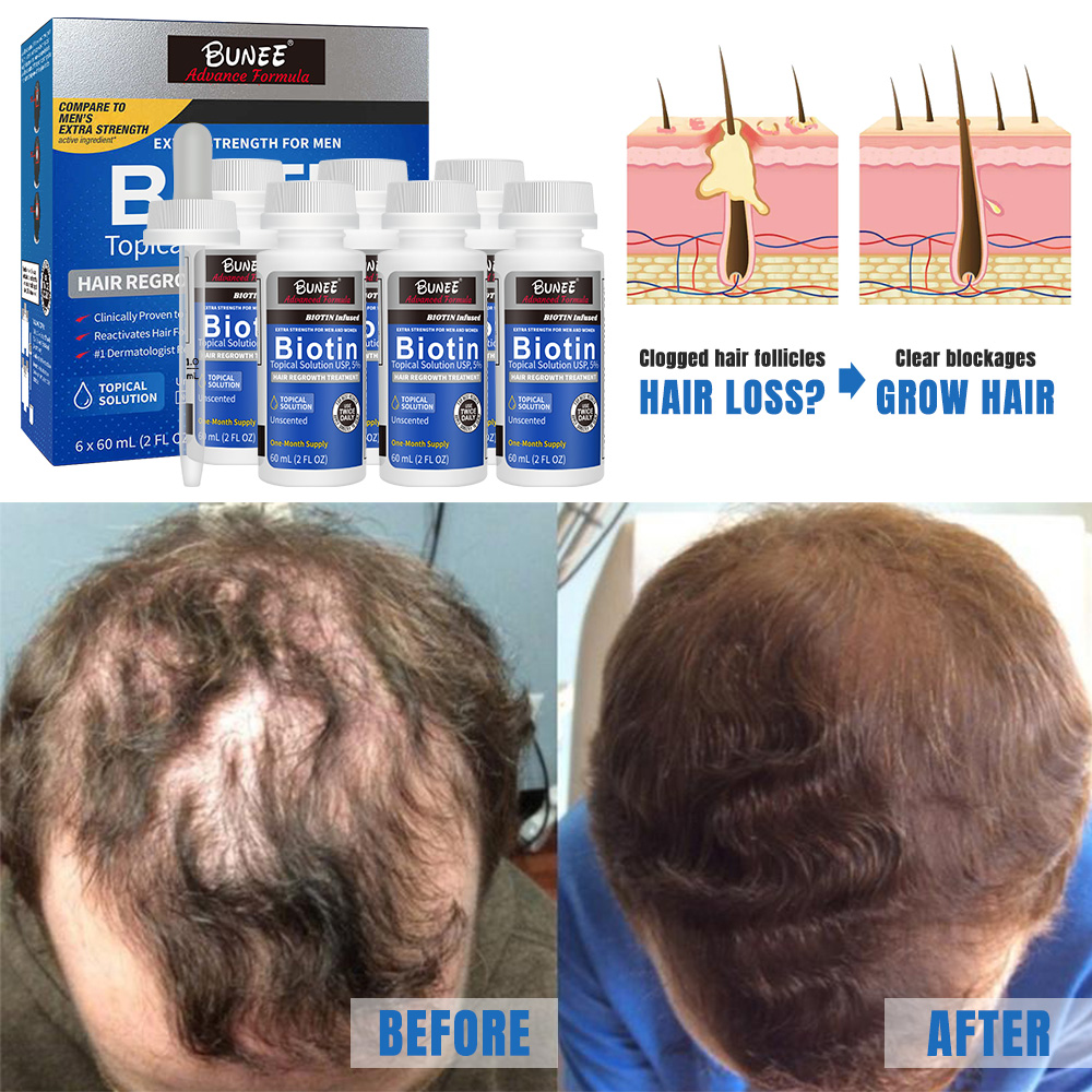 Popular 60ml 5% Kirland Hair Regrowth Treatment Anti-hair Loss Serum Oil Hair Lotion Growth Serum For Men With Dropper