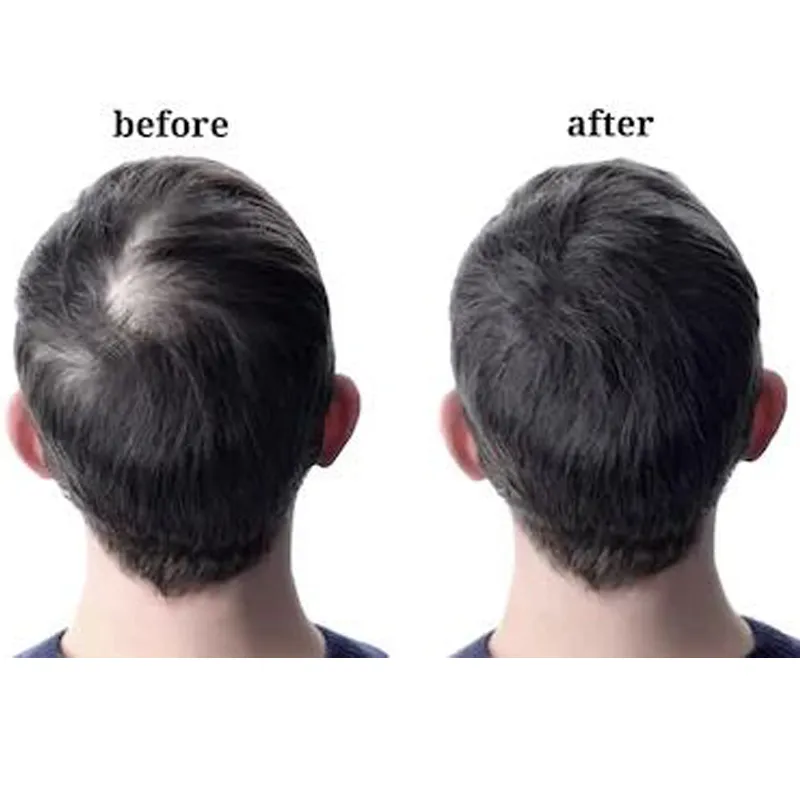 Private Label Ginger Anti Hair Loss Hair Growth Shampoo