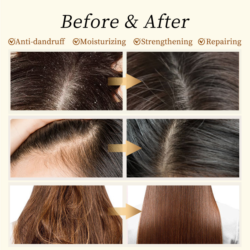 Private Label Repair Shampoo Vegan Organic Natural Argan Oil Rice Water Tea Tree Hair Growth Hair Care Shampoo and Conditioner