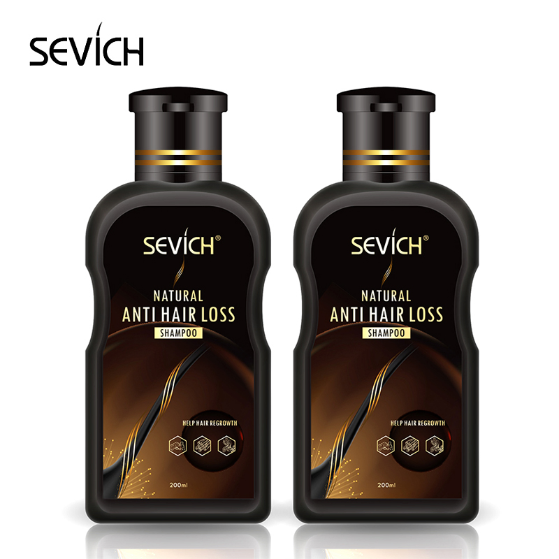 Best Ginger Hair Loss Shampoos for Men and Women