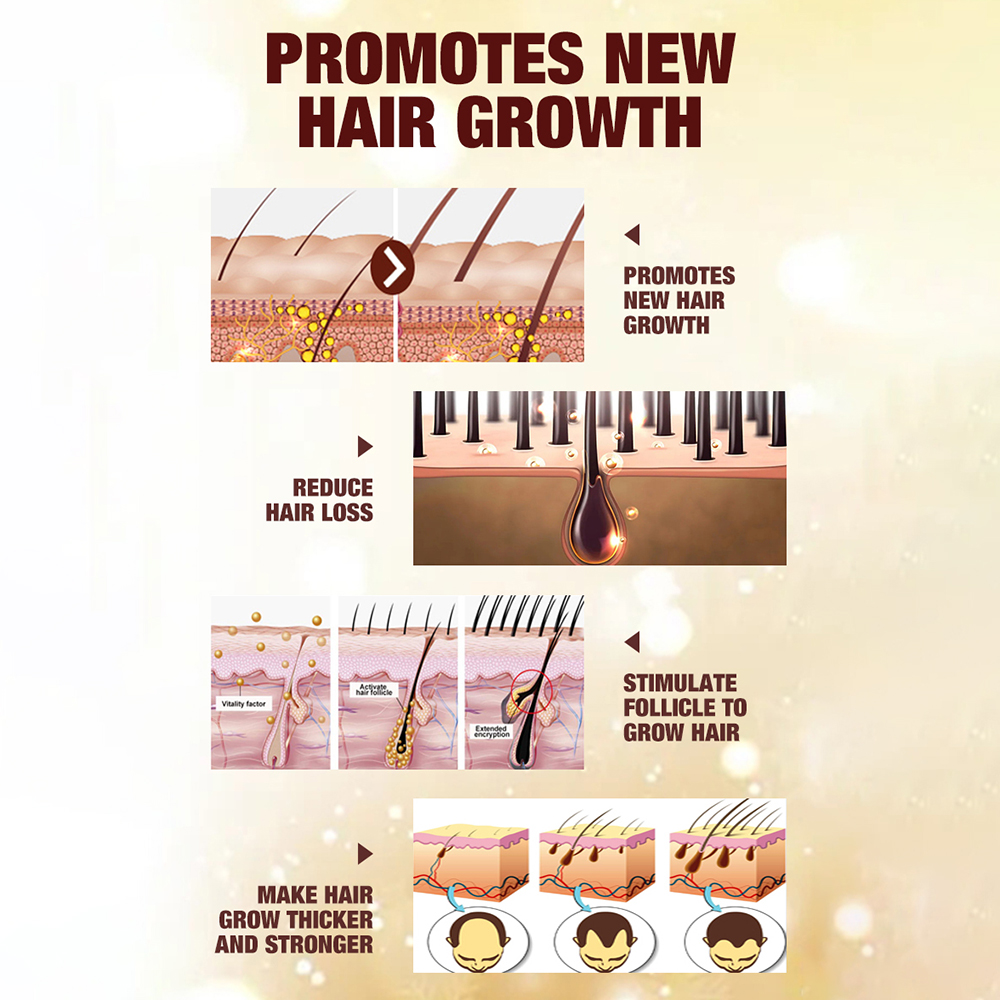 Private Label Organic Biotin Hair Growth Shampoo And Conditioner Set Natural Herbal Thickening Anti Hair Loss Shampoo