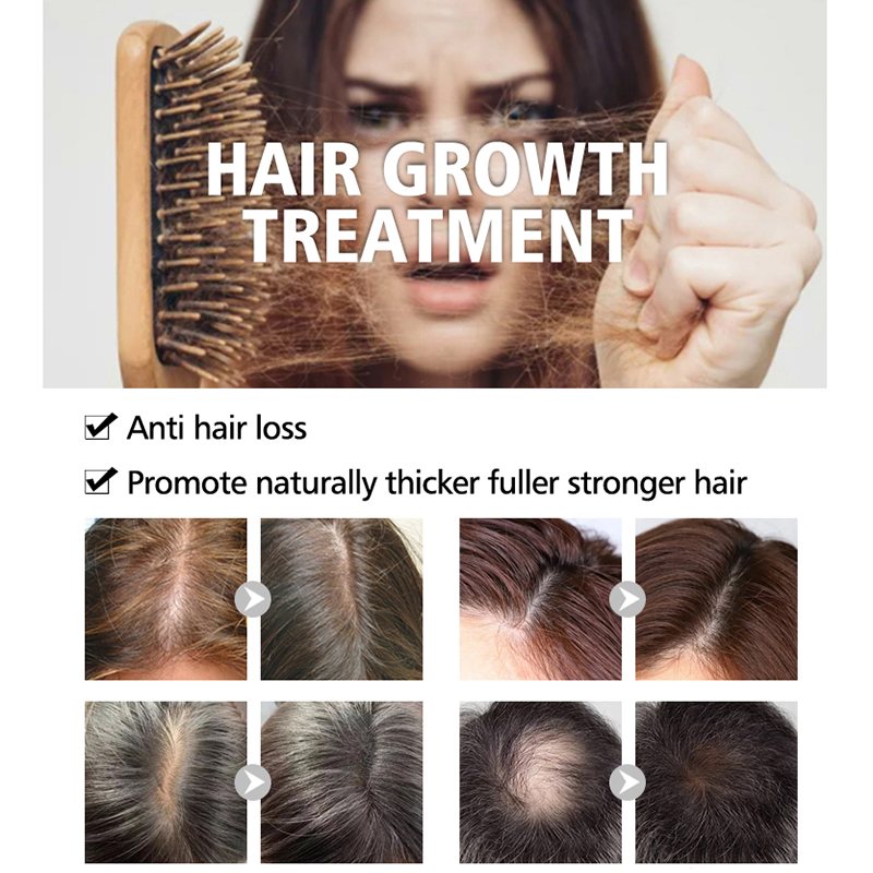 Private Label Organic Biotin Hair Growth Shampoo And Conditioner Set Natural Herbal Thickening Anti Hair Loss Shampoo