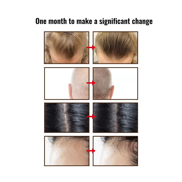 YOGI Anti-fall Hair Growth Smooth Nourishing Biotin Shampoo for Professional Salon
