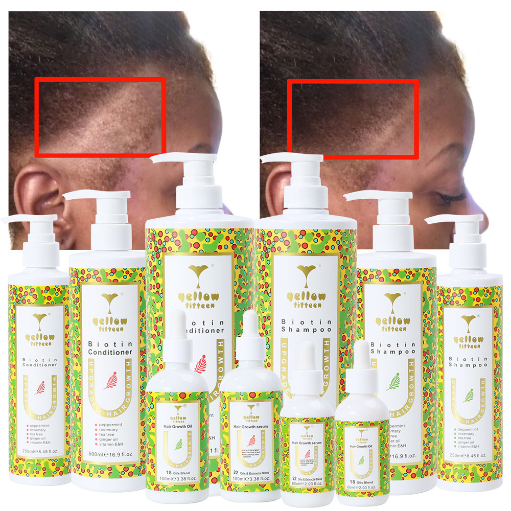 Your Own Brand ORGANIC Shampoo Oem Coconut Oil Biotin Shampoo and Conditioner Hair Care Set for Hair Growth