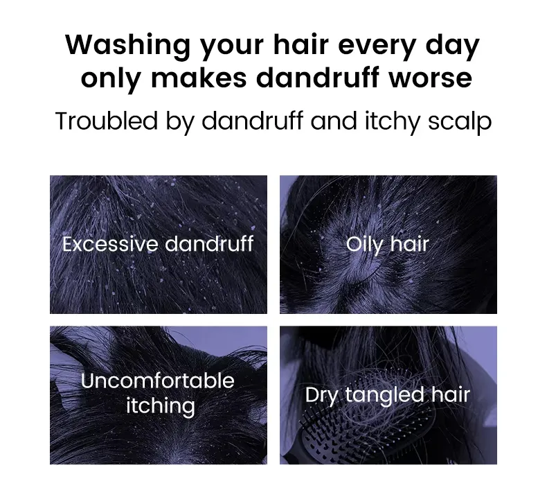 Deep Cleansing Scalp Nourishing Hair Roots Anti-Dandruff & Oil Control Selenium Sulfide Shampoo