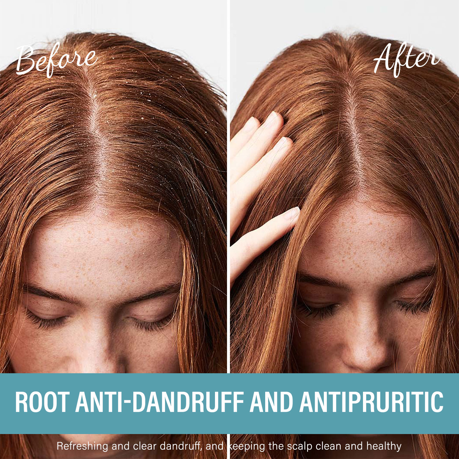 ANN PLATO OEM Private Label Keratin Anti-Dandruff Gel Shampoo 500ml 24Hrs Itchy Scalp Relief Custom Logo Natural Ingredients