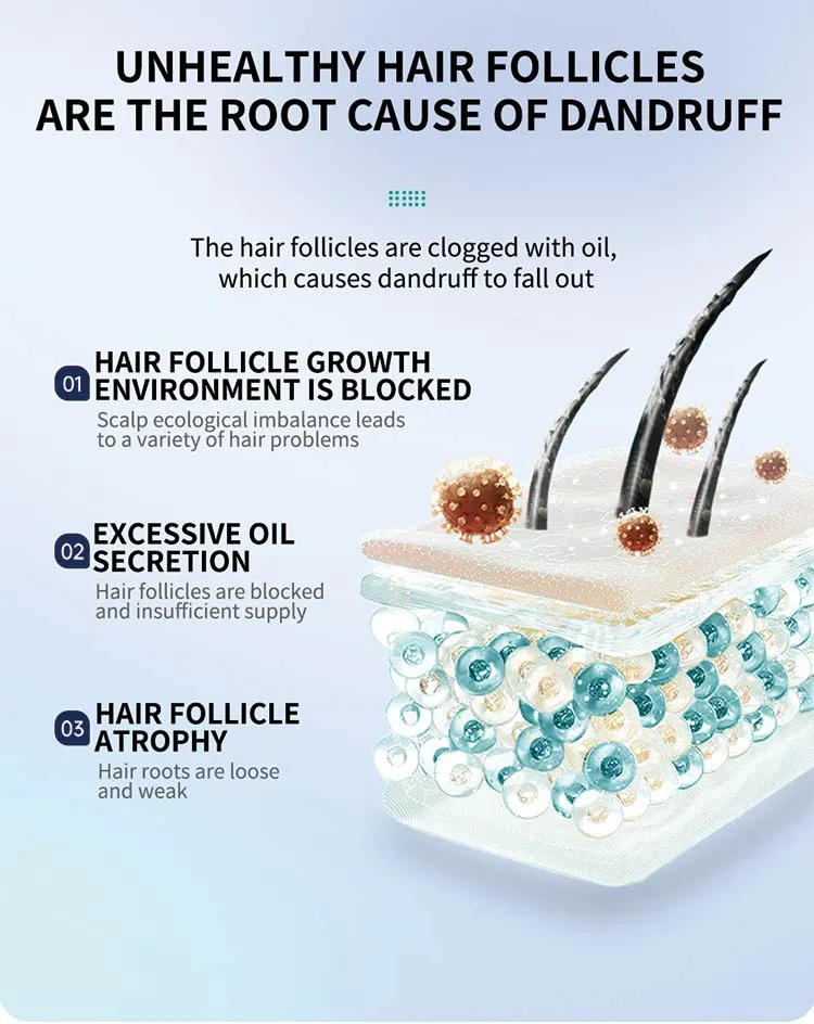 Anti-Dandruff Shampoo Usage