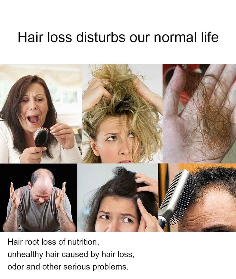 Best Ginger Hair Loss Shampoos for Men and Women Display 3