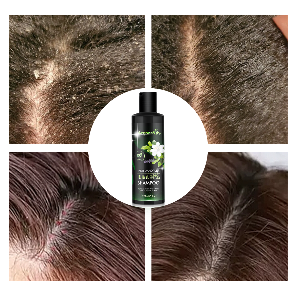 OEM Private Label Scalp Itching and Scalp Treatment Women Tea Tree Mint Perpermint Shampoo