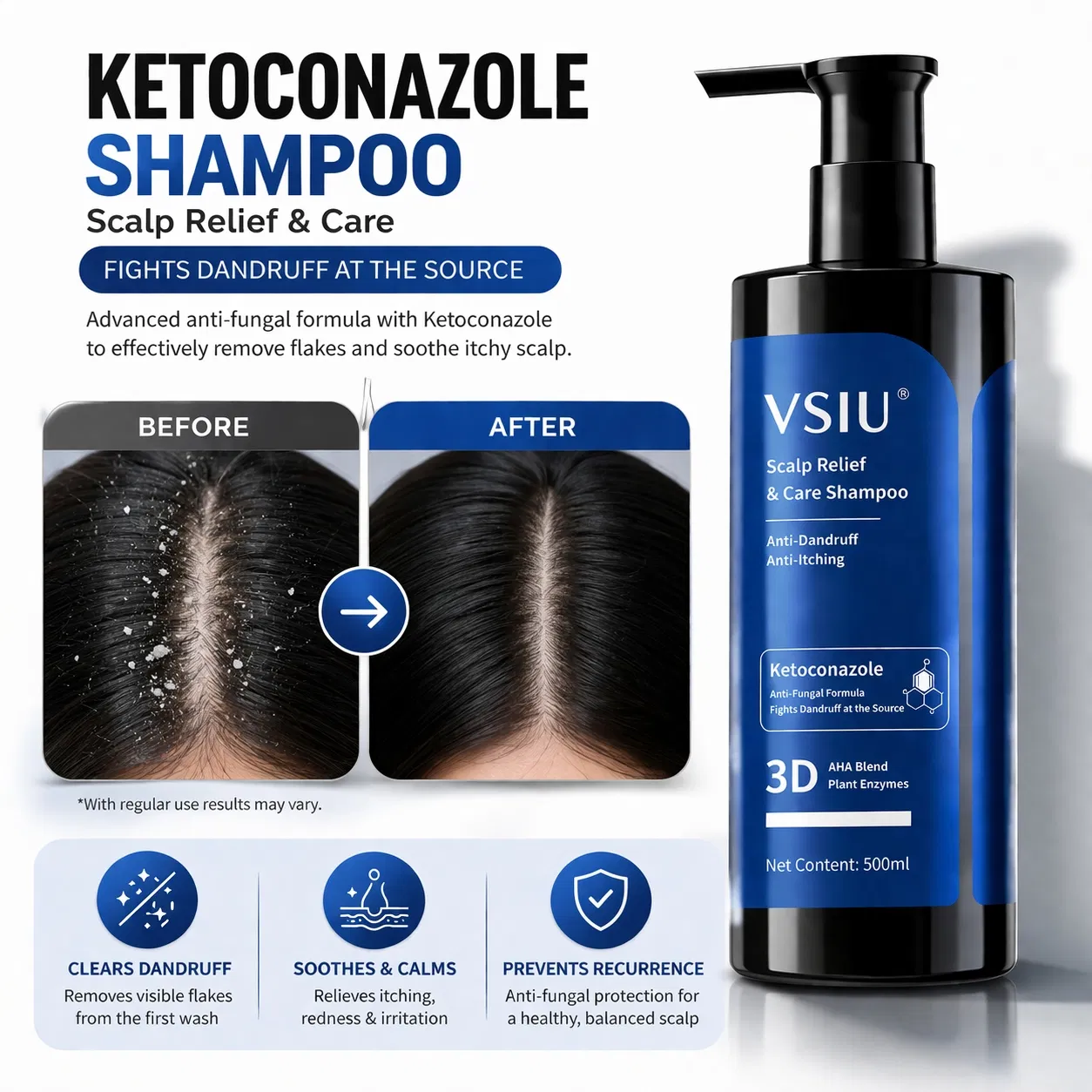 Ketoconazole Shampoo Detail