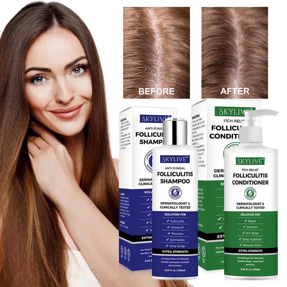 New Arrivals Hair Care Organic Deep Cleansing Shampoo for Revitalizes Scalp Psoriasis Anti-Fungal Shampoo for Folliculitis