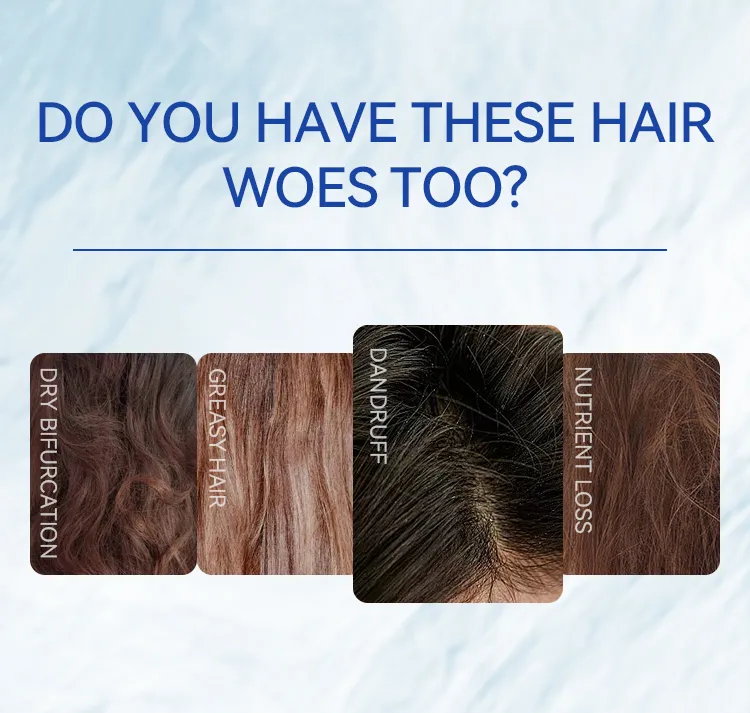 Mocheqi Sulfate Free Mild Organic Nourishing Moisturizing Anti-Dandruff Hair Shampoo for Salon Use Wholesale