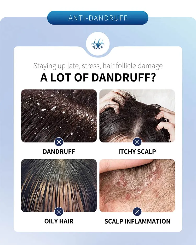Anti-Dandruff Shampoo Detail