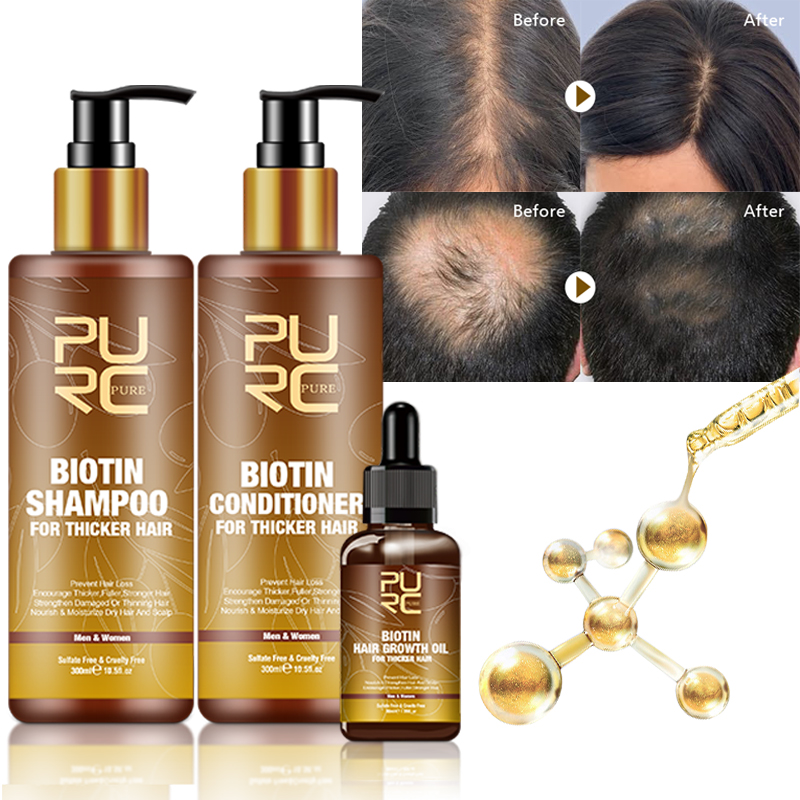 Private Label Organic Biotin Hair Growth Shampoo And Conditioner Set Natural Herbal Thickening Anti Hair Loss Shampoo