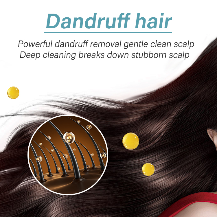 ANN PLATO OEM Private Label Keratin Anti-Dandruff Gel Shampoo 500ml 24Hrs Itchy Scalp Relief Custom Logo Natural Ingredients