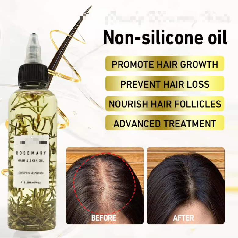 Rosemary Hair Growth Oil &amp; Shampoo Nourishing Anti-Frizz Scalp Care Private Label Wholesale Organic 100ml/200ml