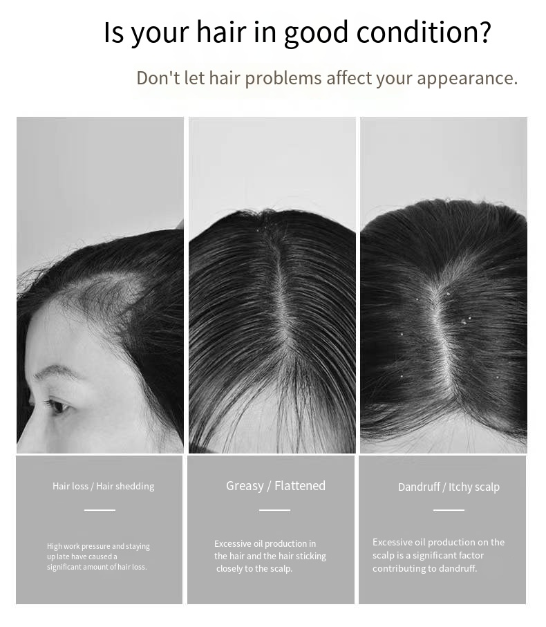 DNA Sodium Oil Control Anti-Hair Loss Anti-Dandruff Shampoo User Tested Reduce Hair Fall 1-3 Weeks Scalp Care Men Women Hair