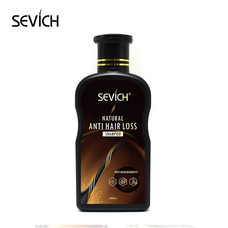 Best Ginger Hair Loss Shampoos for Men and Women