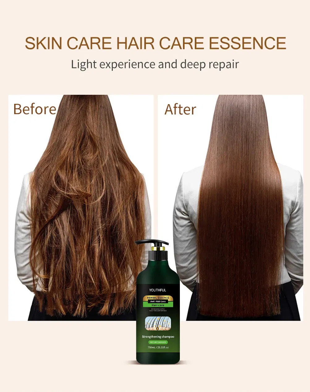 Sulfate Free for Strengthen Weak Hair Shampoo Remove Dandruff and Relieve Itching