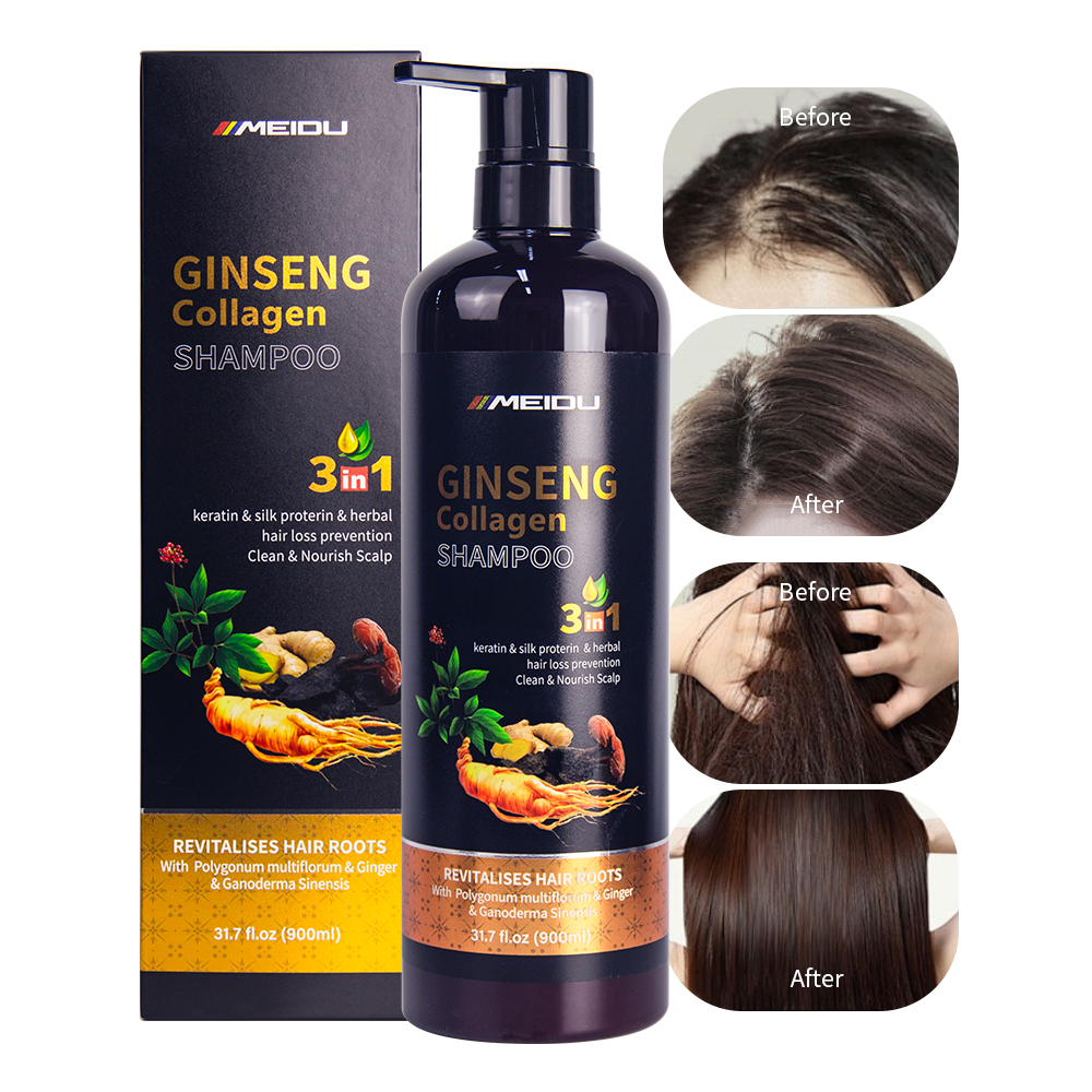 Hair Care Products Ginseng Shampoo and Conditioner Moisturizing Anti-Dandruff Organic Coconut Shampoo