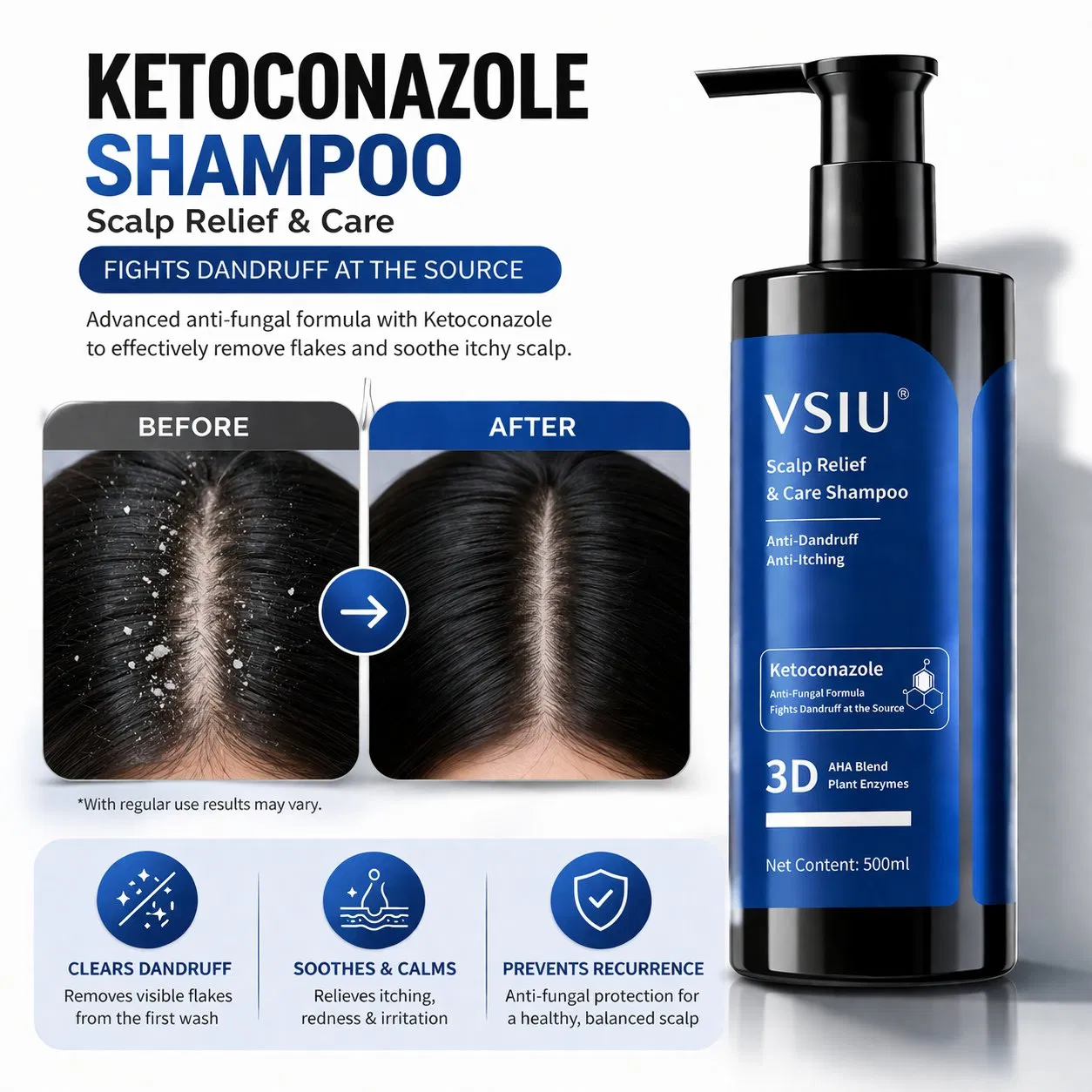 Advanced Ketoconazole Hair Shampoo for Dandruff Control and Scalp Health Best Anti Dandruff