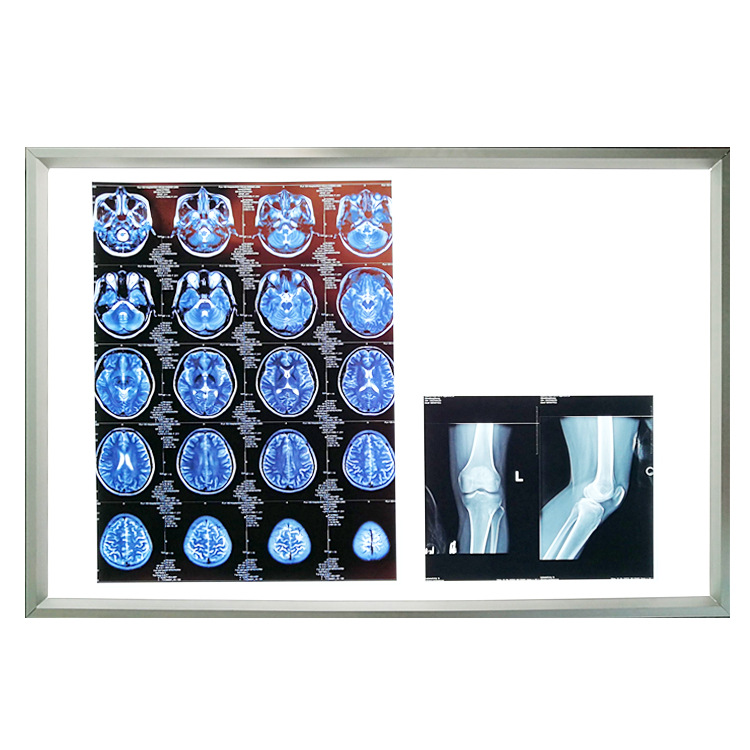 X-ray View Box