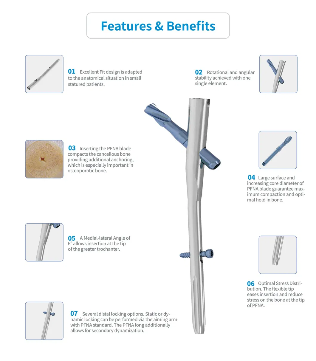 Intramedullary Nails System