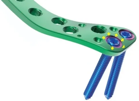 Orthopedic LCP Distal Femoral Locking Plate