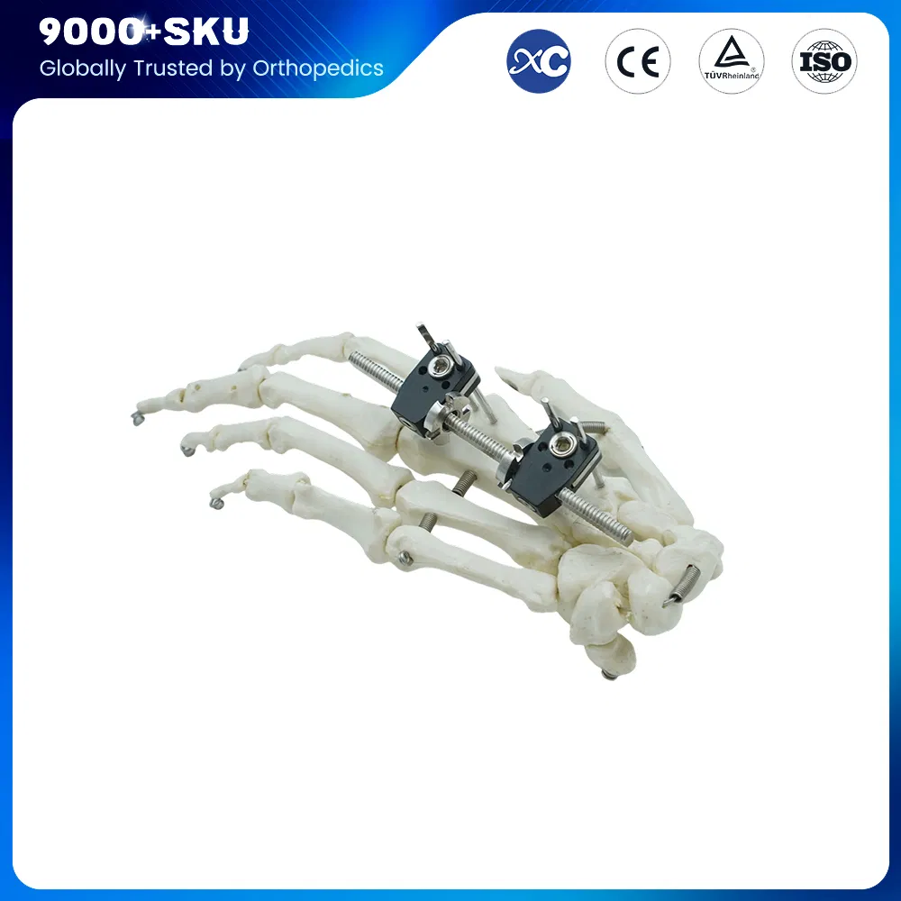 Orthopedic Surgery Trauma Manufacturer Finger External Fixator for Mini Fixator