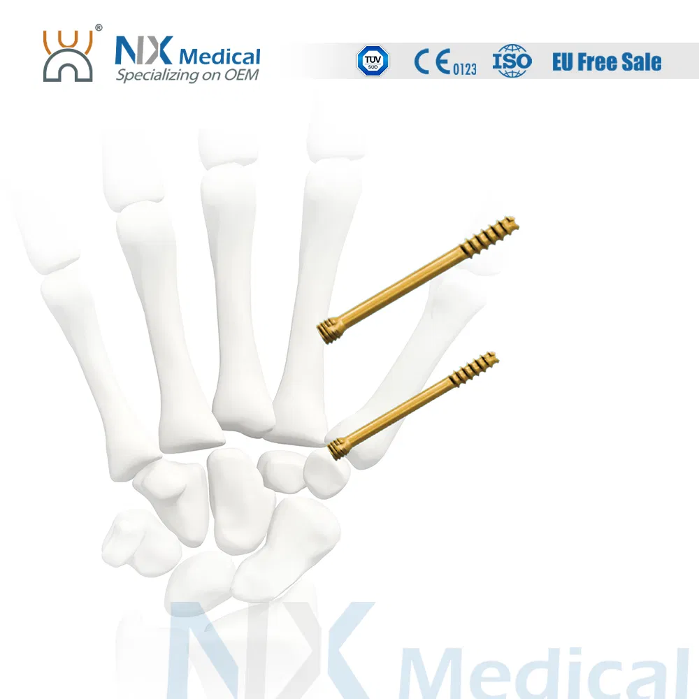 Orthopedic Implant Cannulated Headless Compression Screw Bone Screw Fixation