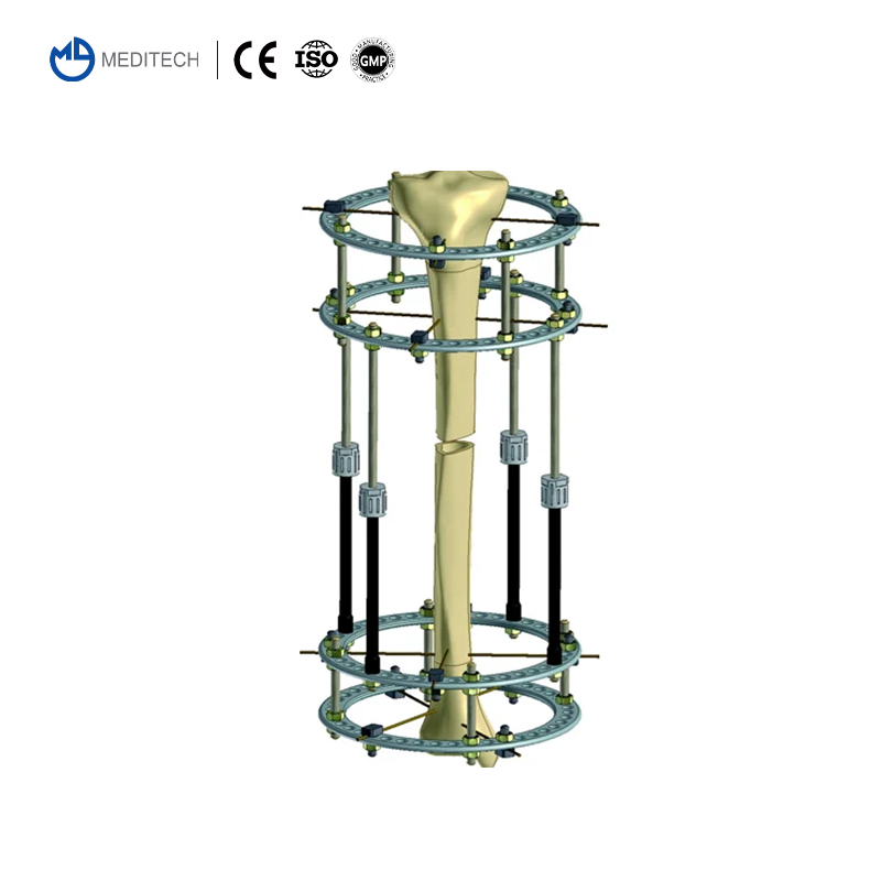 Orthopaedic Instruments Ilizarov Ring External Fixator for Tibial &amp; Femur Fracture