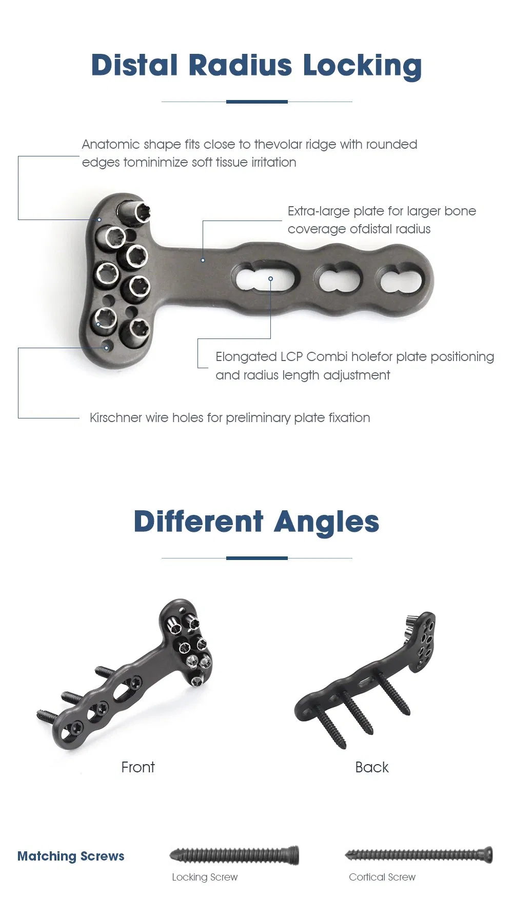 Titanium Plate View 3
