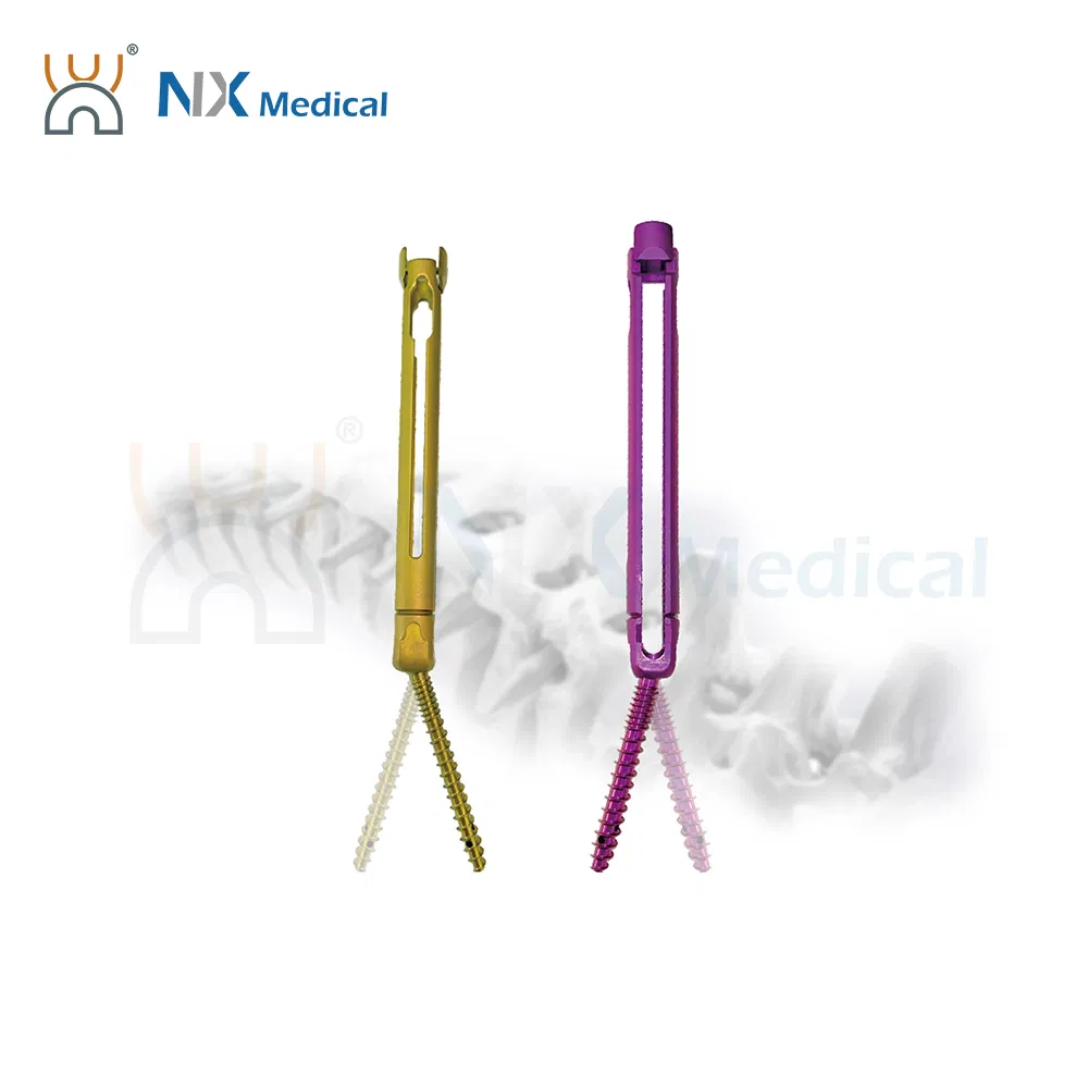 Nx Medical Spine Implant Cannulated Bone Cement Pedicle Screw for Spine Deformity