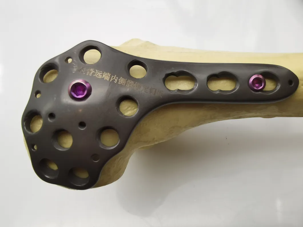 Distal Femur Medial Condyle Locking Plate