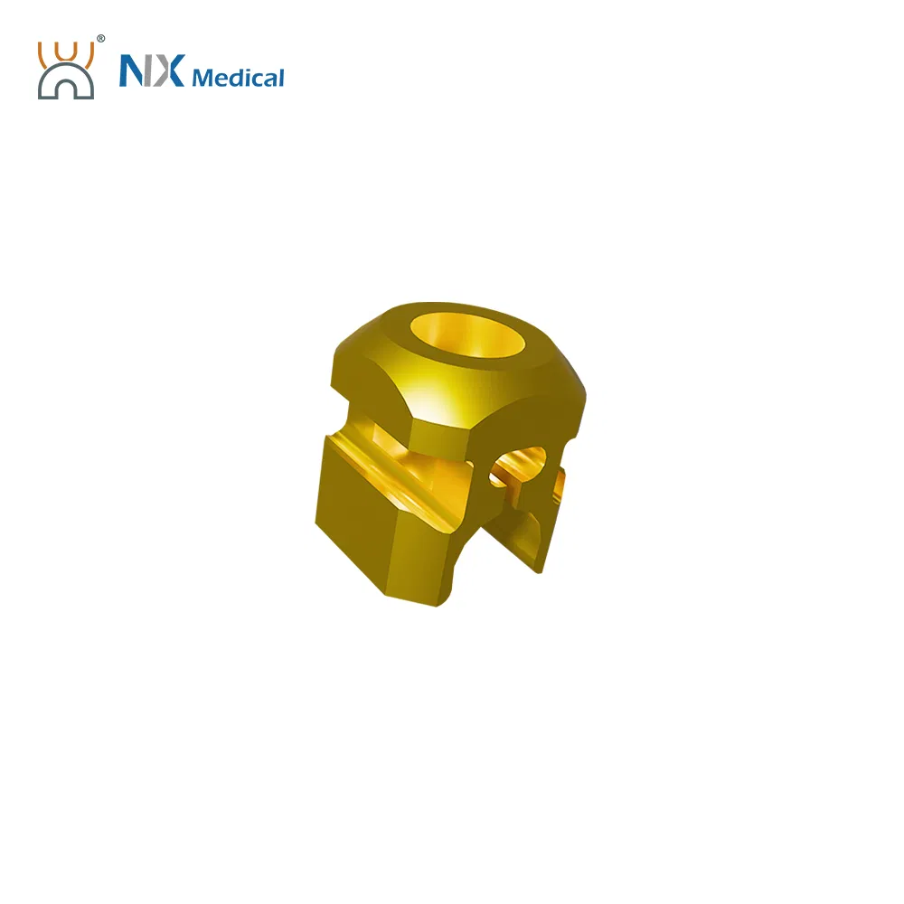 Nx Medical Sf-IV Mis Cannulated Bone Cement Spinal Pedicle Screw 5.5mm for Bone Fixation
