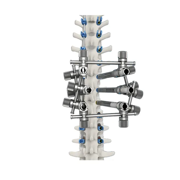 Thoracolumbar Pedicle Screw System 2
