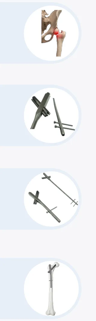 Advantage Illustration