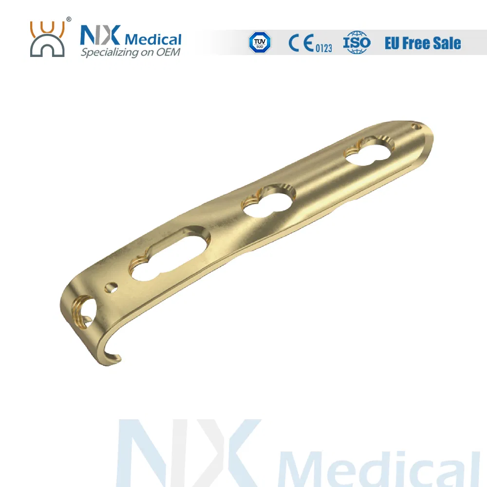 Nx Medical Orthopedic Locking Plate Small Fragment System for Trauma Fixation