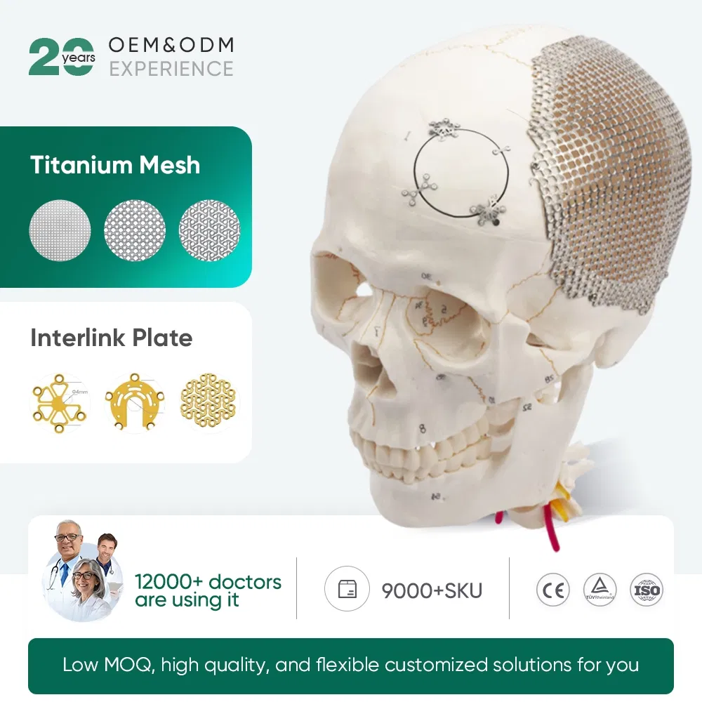 Titanium Mesh Implants